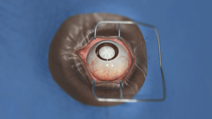 FundamentalVR запускает симулятор операции на глазах в виртуальной реальности