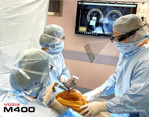 Pixee Medical получила одобрение FDA на хирургические операции при помощи умных очков Vuzix M400