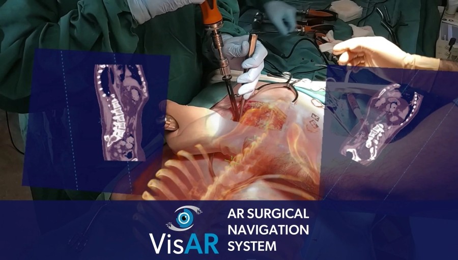 VisAR - AR-система для хирургии позвоничника на базе Microsoft Hololens 2
